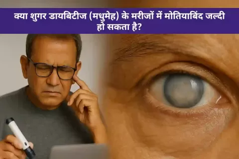 क्या शुगर डायबिटीज (मधुमेह) के मरीजों में मोतियाबिंद जल्दी हो सकता है?