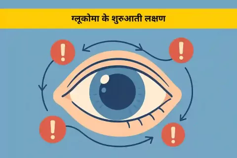 ग्लूकोमा के शुरुआती लक्षण जिन्हें नज़रअंदाज़ नहीं करना चाहिए