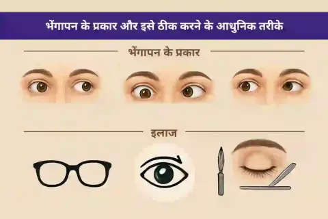 भेंगापन (स्क्विंट) के प्रकार और इलाज के आधुनिक विकल्प: जानिए संरेखण सुधार की पूरी जानकारी