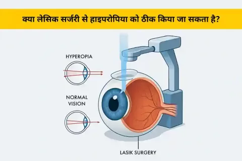 क्या लेसिक सर्जरी हाइपरोपिया (Hyperopia) को ठीक कर सकती है? जानिए कारण, लक्षण और समाधान