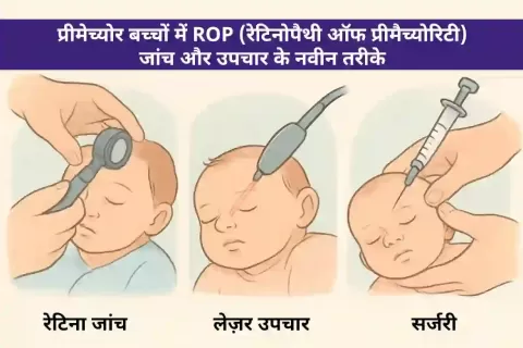 प्रिमैच्योर बच्चों में ROP (रेटिनोपैथी ऑफ प्रिमैच्योरिटी): जांच और आधुनिक उपचार विधियाँ