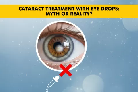 Can Cataracts Be Treated With Eye Drops?