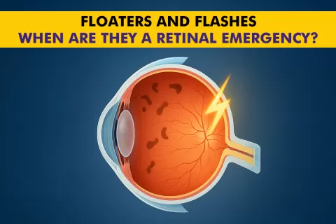Floaters and Flashes in the Eye: When to Seek Urgent Care