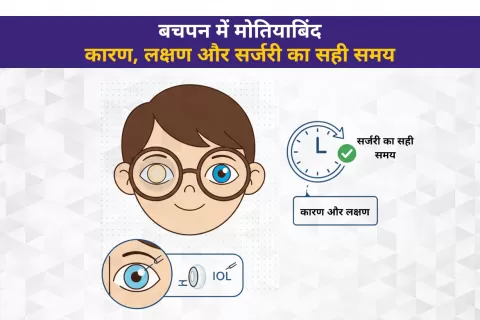 बचपन में मोतियाबिंद: कारण, लक्षण और सर्जरी का सही समय