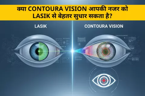 कॉन्टूरा विजन बनाम लेसिक सर्जरी | दोनों सर्जरी में क्या अंतर है?