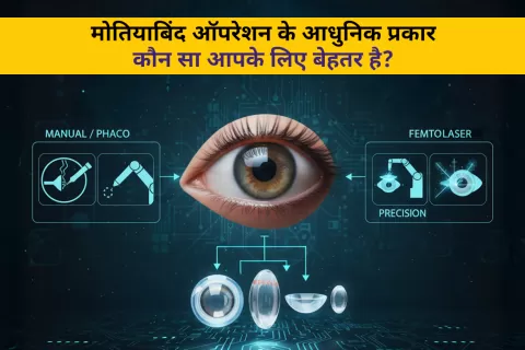 मोतियाबिंद सर्जरी के प्रकार: फेको और लेज़र तकनीक की पूरी जानकारी