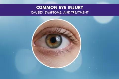 Common Eye Injury: Symptoms, Causes, and Treatment