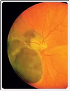 Don't Let Your Eyes Reveal Your Age