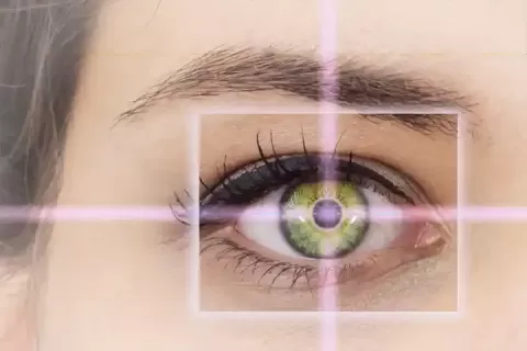 LASIK Technology Advancements| Evolution of Modern LASIK