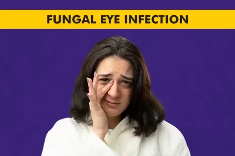 Fungal Eye Infection (Fungal Keratitis): Signs and Treatment