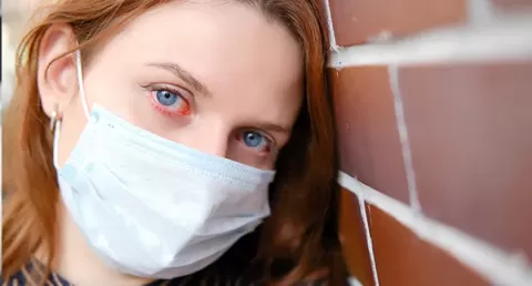 Is there a link between red eyes and Coronavirus?