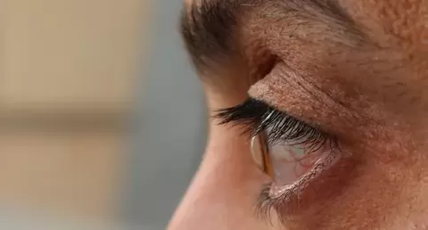 Important Things to Know Before Undergoing Keratoconus Surgery