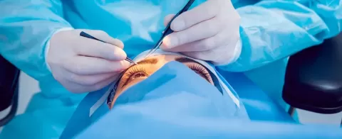 Laser Cataract Surgery: Procedure, Benefits, Risks and Cost