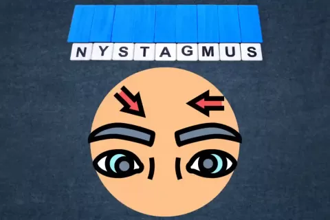 Nystagmus - Causes, Types, Symptoms and Treatments