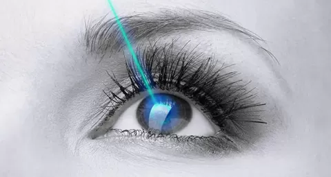 SMILE vs Contoura Vision ? Understanding the Differences