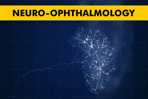 What Is Neuro Ophthalmology and When Should You See a Specialist
