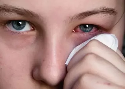 How to Get Rid of Eye Discharge?