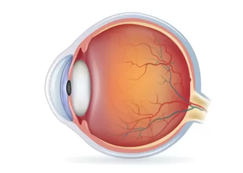 Retinal Tears: Why They Happen and Who Is Most at Risk
