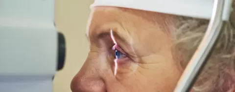 मोतियाबिंद (Cataract): लक्षण, कारण और उपचार