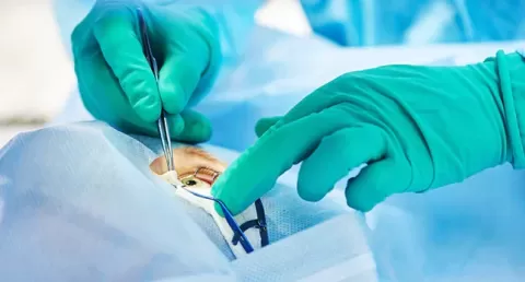 Eye Tumour Treatment
