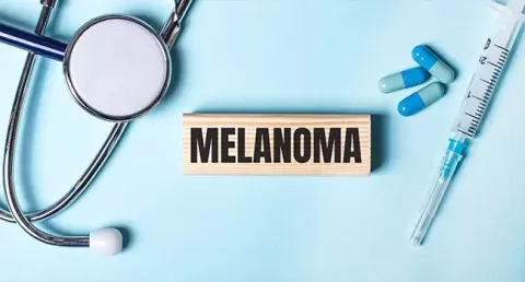 Melanoma of the Eye: What to Watch For and What Helps?