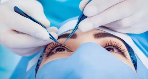 The Nuts &amp; Bolts Of SMILE Laser Eye Surgery