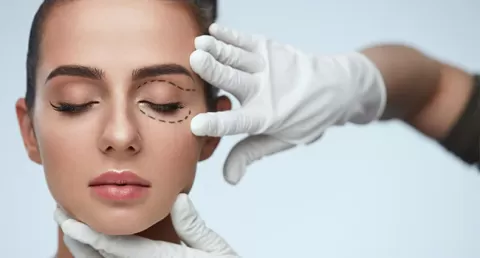 What is Meant by Oculoplasty?