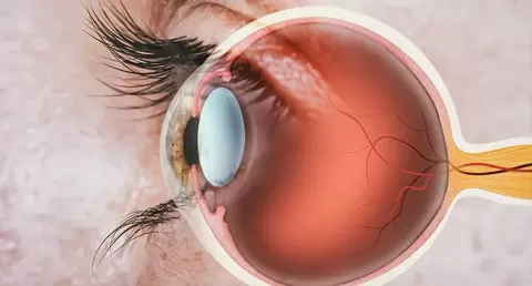 What are the types and symptoms of common retinal diseases?