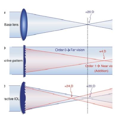 Multifocal Lens