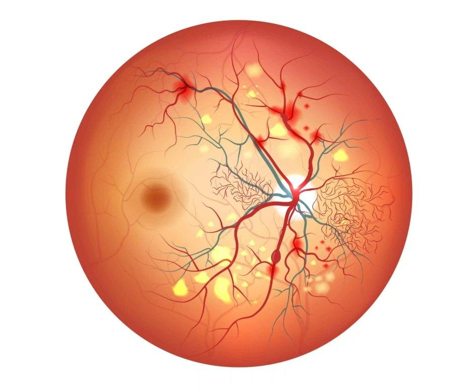 Spontaneous gene changes risk factors